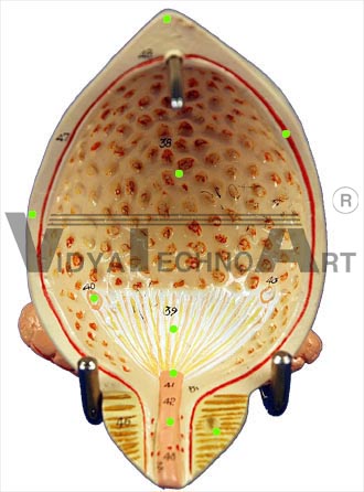 Urinary Bladder - Internal View